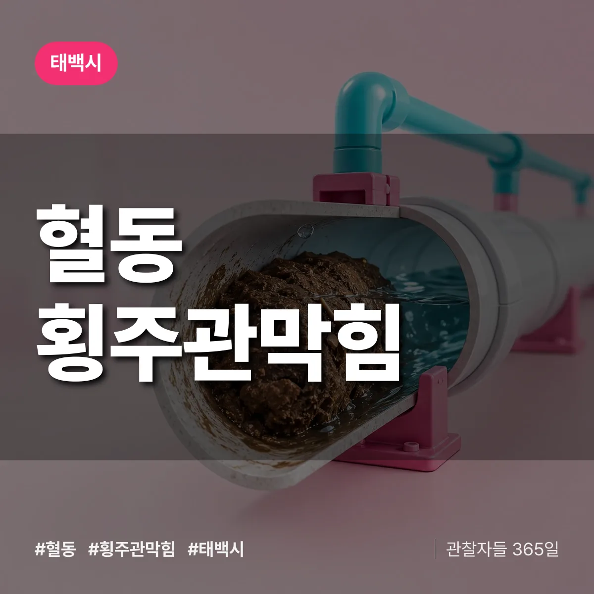 혈동 횡주관막힘 배너